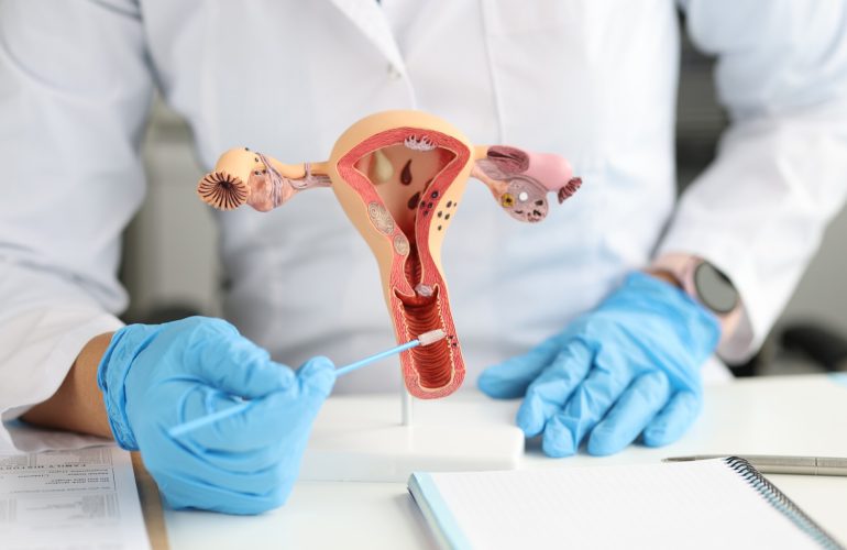 gynecologist-holds-urogenital-cytobrushes-model-female-reproductive-system-female