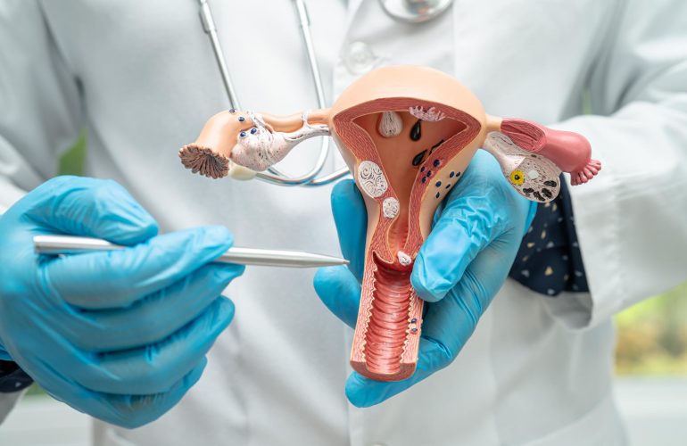 uterus-doctor-holding-anatomy-model-study-diagnosis-treatment-hospital